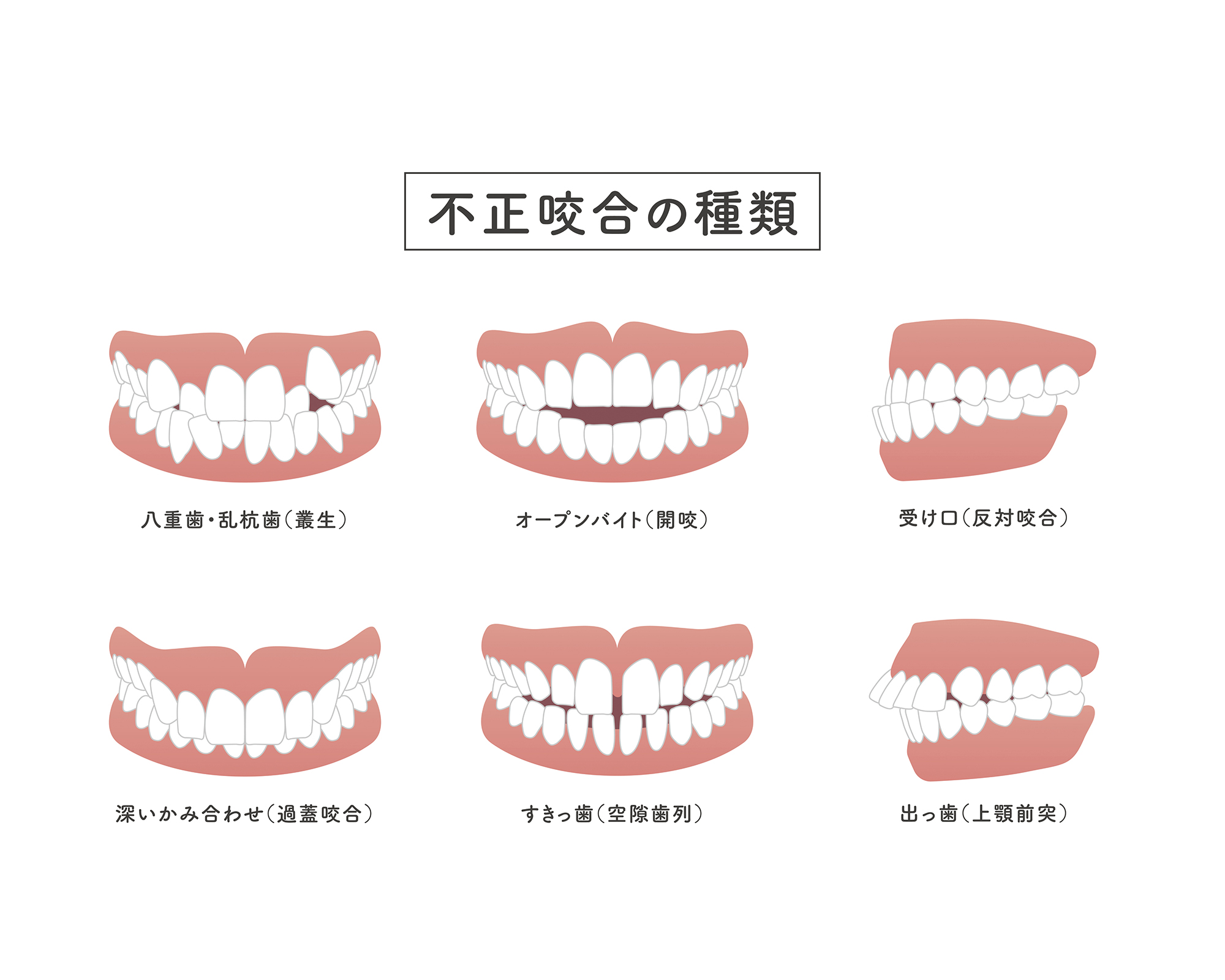 矯正治療